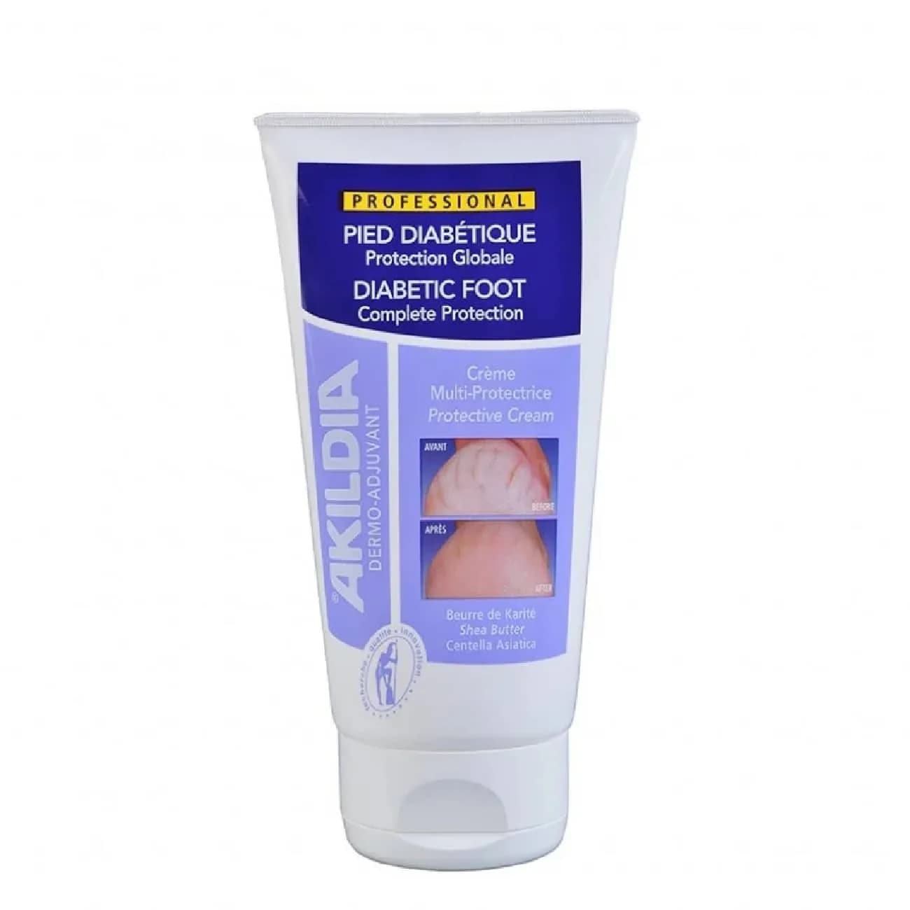 Akildia Cr Pe Diabet 150ml